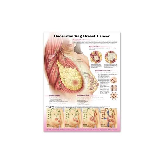  Understanding Breast Cancer 3E Paper