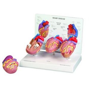 Mini Heart Set Models