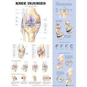 Knee Injuries Anatomical Chart, Laminated, 20"x26"